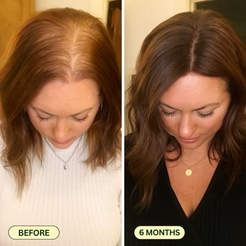 Hair Growth & Reset Oil