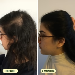 Hair Growth & Reset Oil